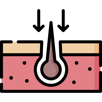 Hair transplant