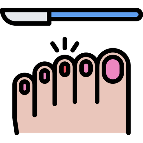 Nail surgery