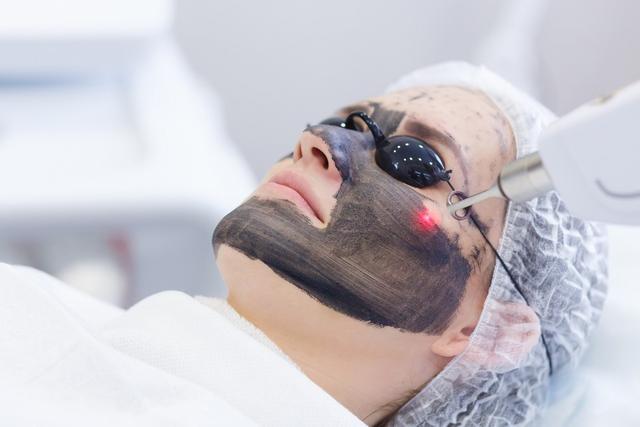 Q-Switched ND YAG Laser
