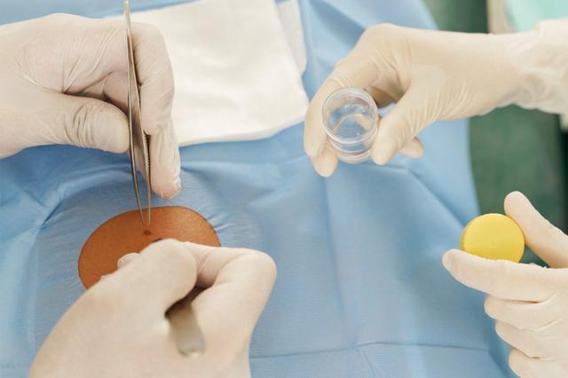 Skin biopsy