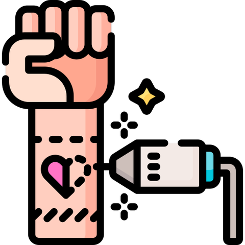 Tattoo Removal