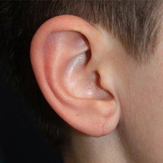 after treatment