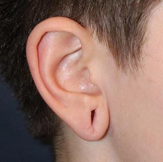 before treatment