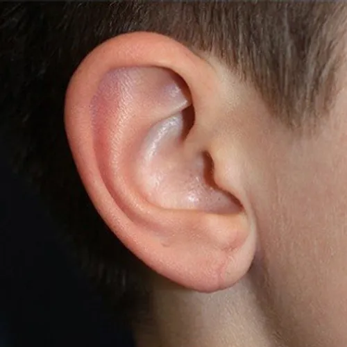 after treatment after treatment