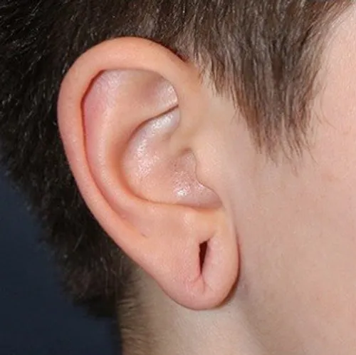 before treatment before treatment