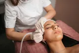 Micro-dermabrasion
