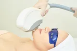 Photo Facial