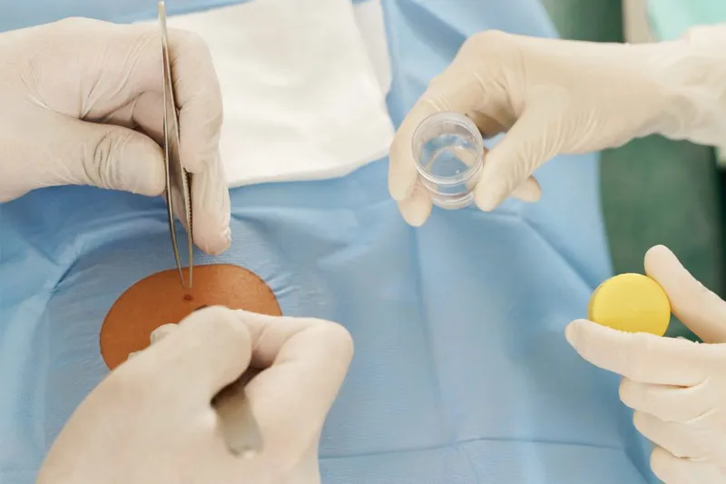 Skin Biopsy