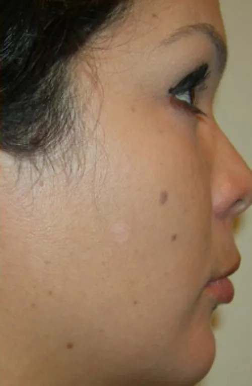 after treatment after treatment