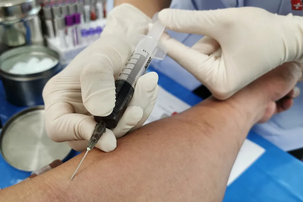 Stem Cell Therapy